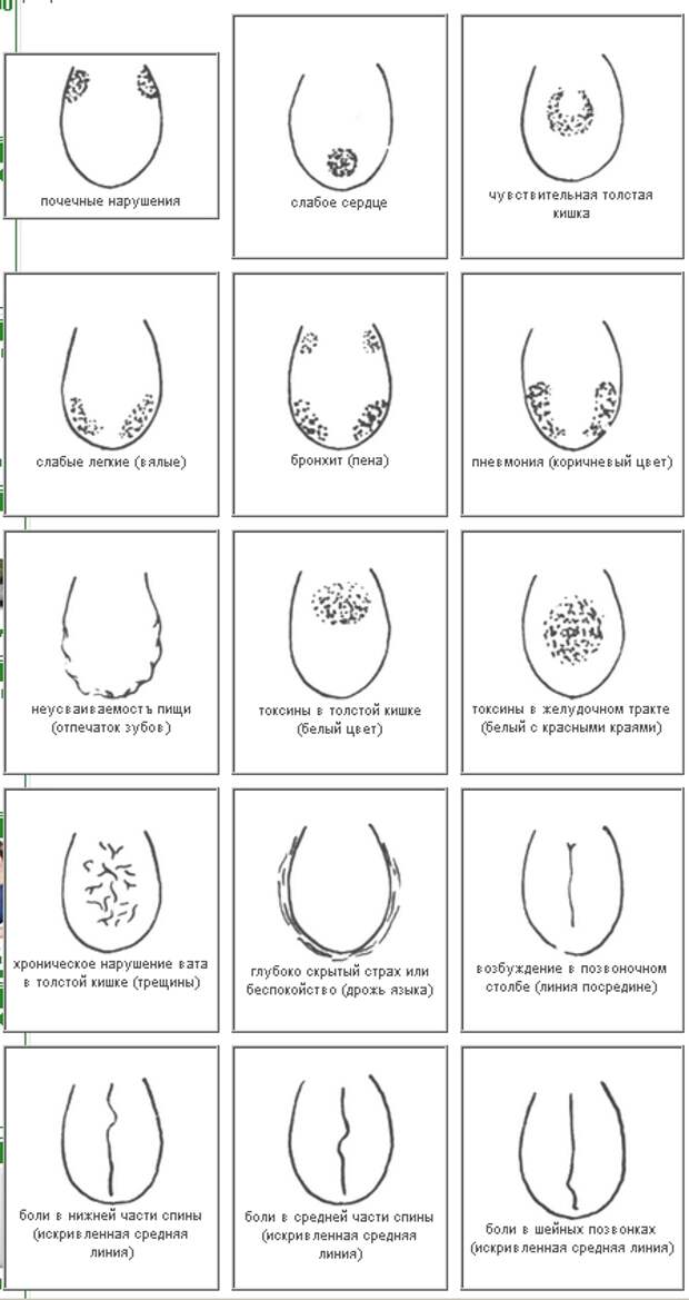 Диагностика по языку в картинках болезней человека китайская медицина