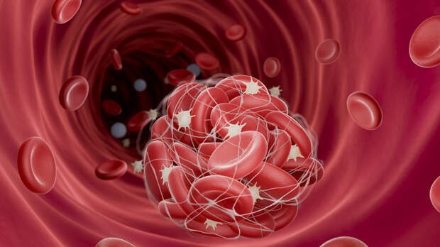 Гинеколог: при тромбофилии противопоказаны гормональные контрацептивы