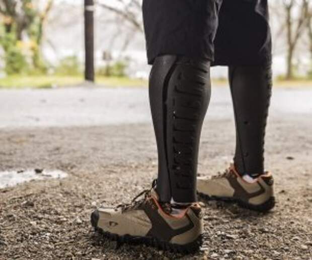 digitalization-prosthetics-recover-7