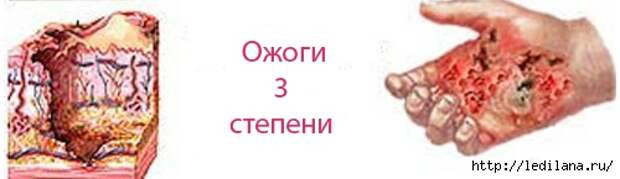 3925311_Stepeni_ojogov_3 (500x145, 52Kb)