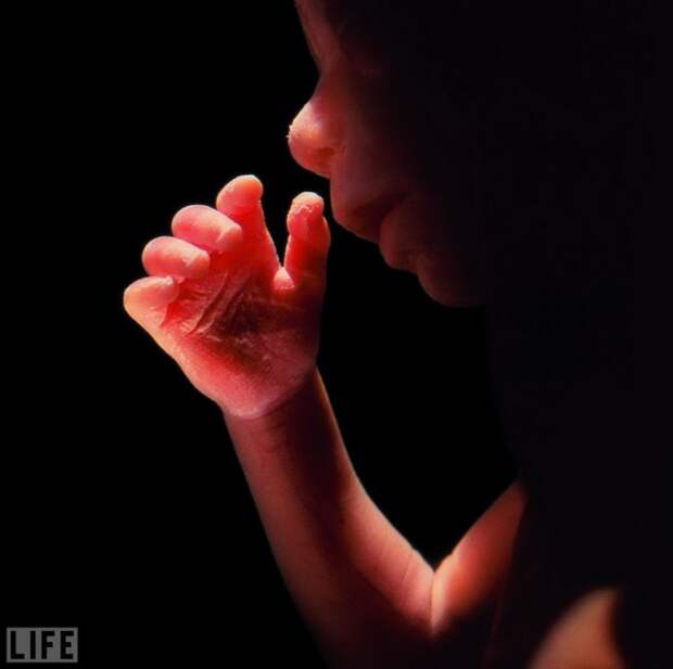 A Child Is Born журнал Life, лучшее, фото