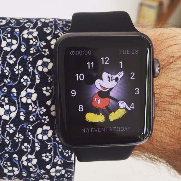 Picture of Simon's wrist wearing the Apple Watch