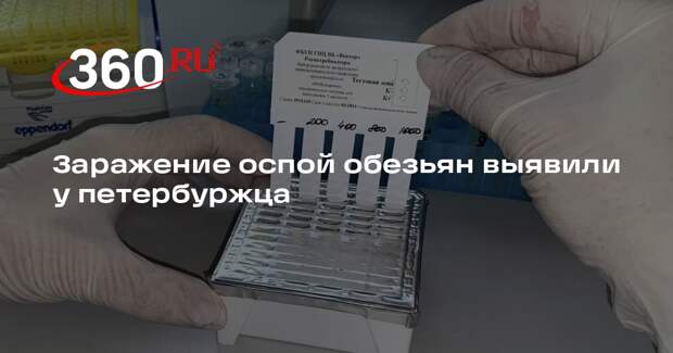 Зараженного оспой обезьян петербуржца отправили в инфекционный стационар