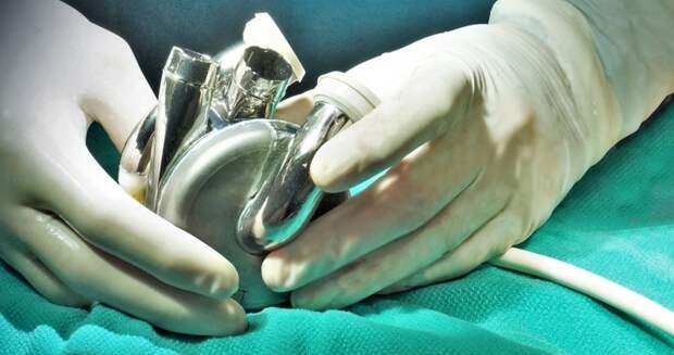 Хирург Жульков назвал маловероятным создание искусственного сердца