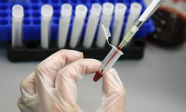 Врач рассказал, какие анализы нужно сдавать мужчинам после 40 лет