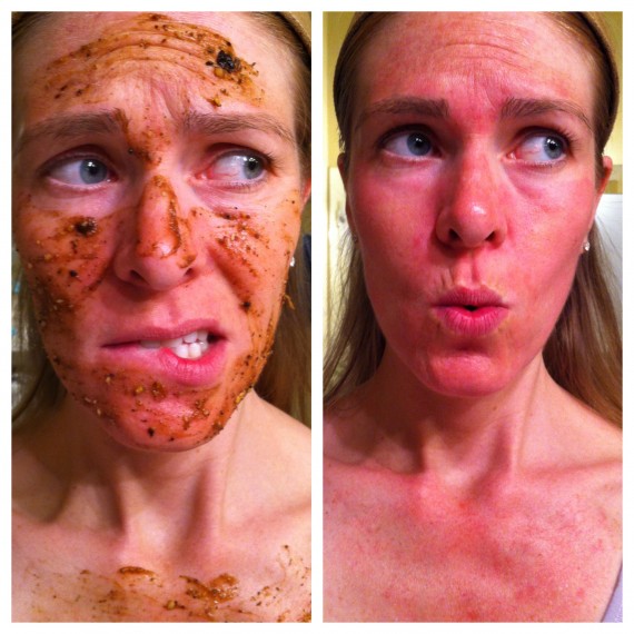 placenta-facial-570x570