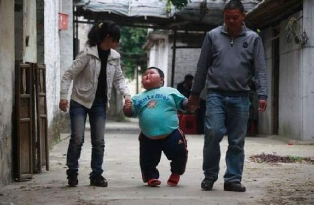 Вот как выглядит самый толстый ребенок в мире! Родители только разводят руками...