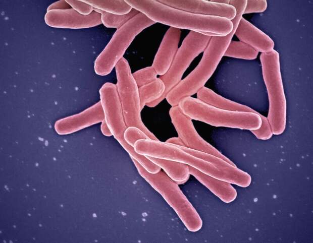 В Дальнегорске выявлено два новых случая заболевания туберкулезом среди школьников, общее число инфицированных достигло девяти