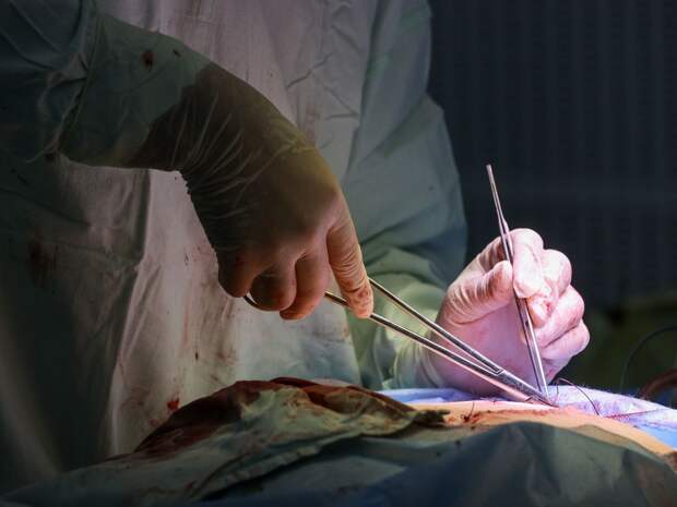 Тюменские врачи помогают юной пациентке восстановиться после сложной операции на мозге