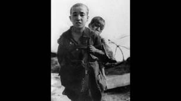 Фото от 10 августа 1945 г.: два брата, переживших атомный взрыв.