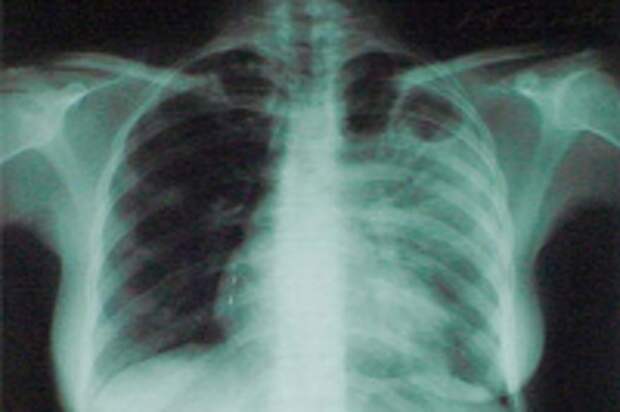 фото:narodmedicina.ucoz.ru