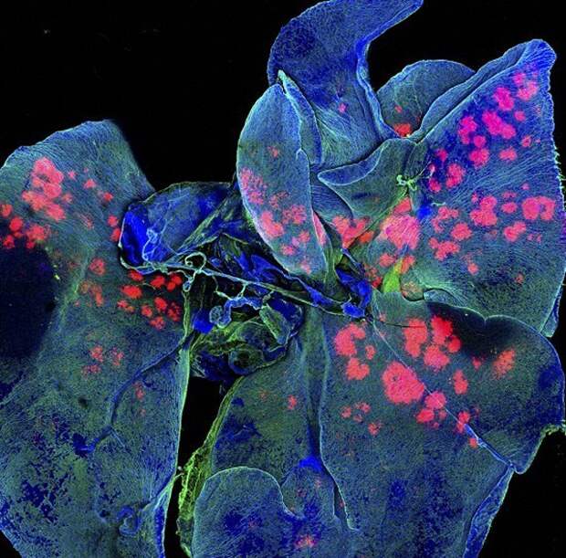Микрографическое изображение легких мыши. Красным и розовым цветом показаны микрочастицы, переносящие лекарства, через неделю после приема.
