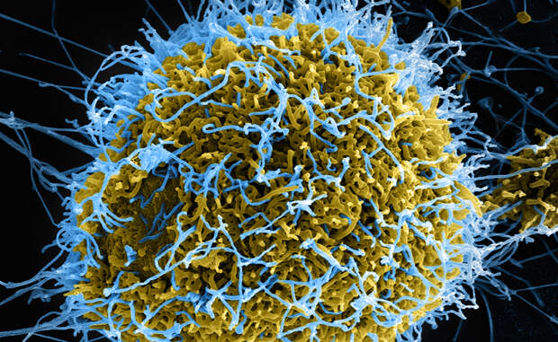 Ученые уже проверили теоретические выкладки практической работой в лаборатории. Макромолекулу «натравили» на несколько вирусов, включая Эболу и лихорадку Денге. Результат в точности соответствовал ожиданиям: макромолекула действительно сумела блокировать работу гликопротеинов в вирусе, а манноза предотвратила заражение клеток иммунной системы.