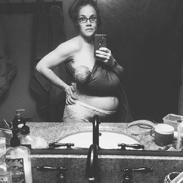 Вот как выглядит тело женщины спустя 24 часа после родов... Шокирующее фото!