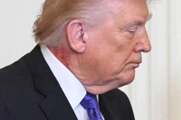 В Белом доме не стали отвечать на вопрос о красном пятне на шее Трампа