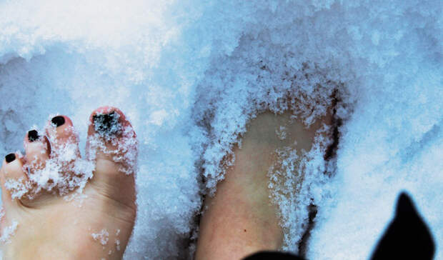 Что делать при обморожении