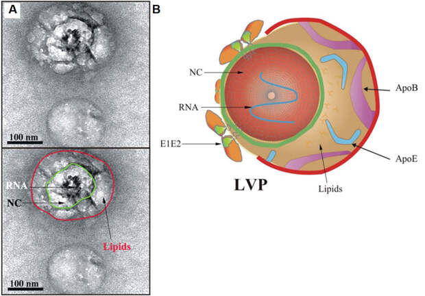 Электронная микрофотография вируса гепатита С в сыворотке крови