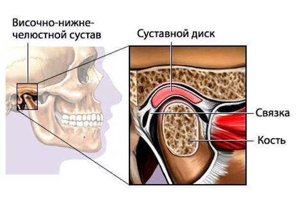 Лечение дисфункций височно-нижнечелюстного сустава
