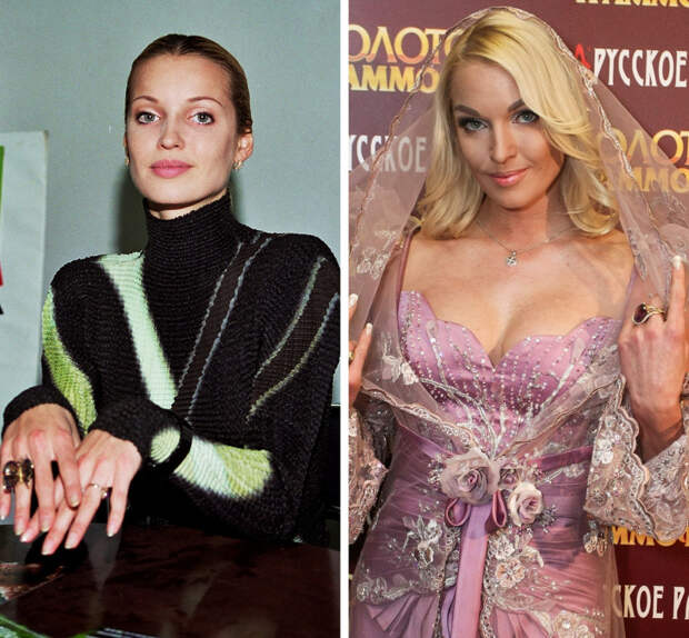 18 российских знаменитостей, которые со временем будто превратились в другого человека
