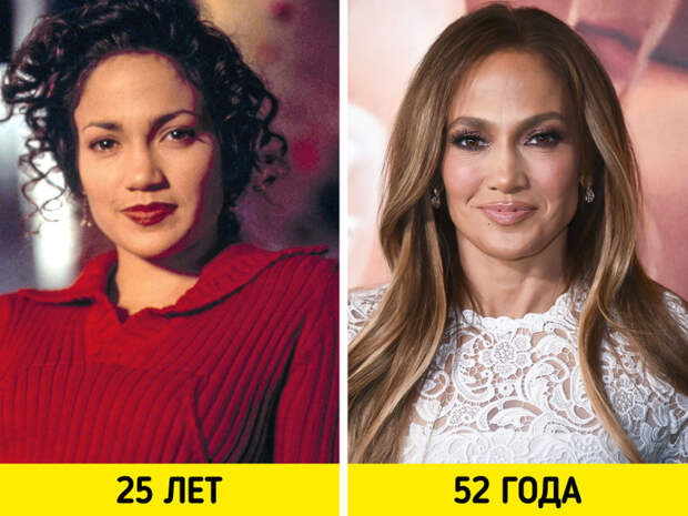 Как изменились знаменитости, которых раньше ценили за естественную красоту
