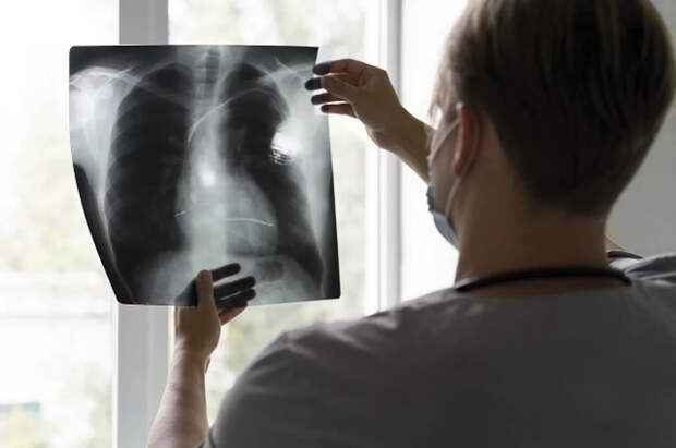 Число случаев туберкулеза в Великобритании выросло на четверть