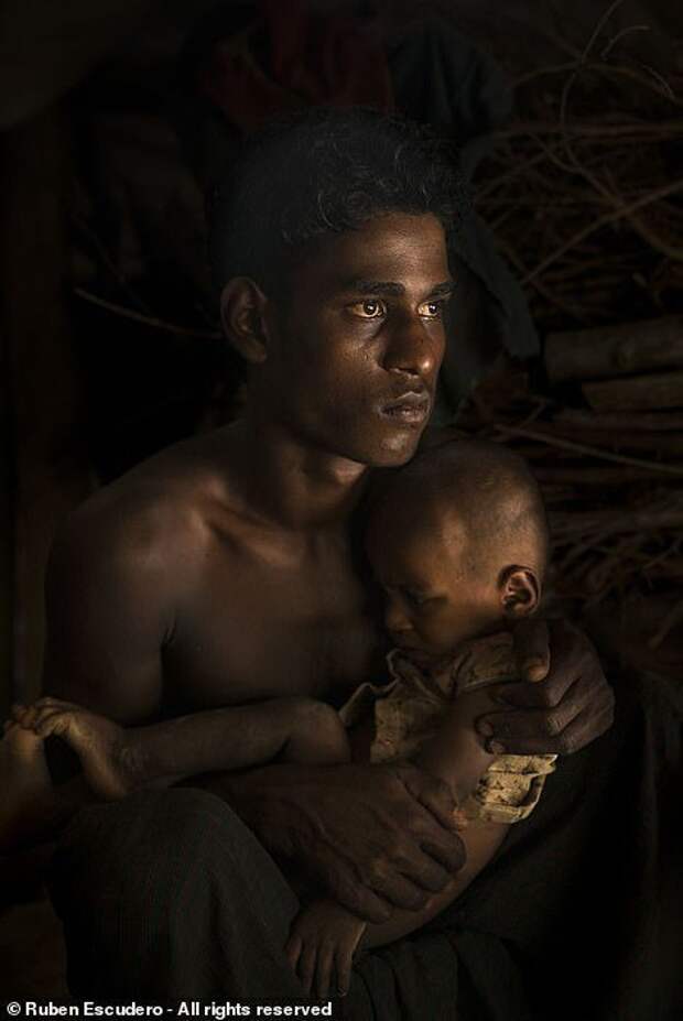 Отец успокаивает своего больного двухлетнего сына. Бангладеш. Лагерь беженцев из Мьянмы. Фотограф: Рубен Эскудеро, Мексика Smithsonian Photo Contest, Претенденты, красота, лучшие фото, фотографии года, фотографы, фотоконкурс, фотоконкурсы