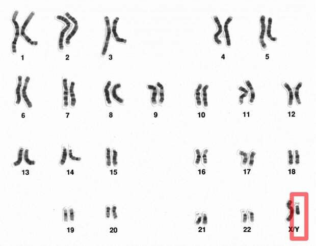 У людей Y-хромосома (в красном прямоугольнике) гнездится в 23-й паре хромосом. 