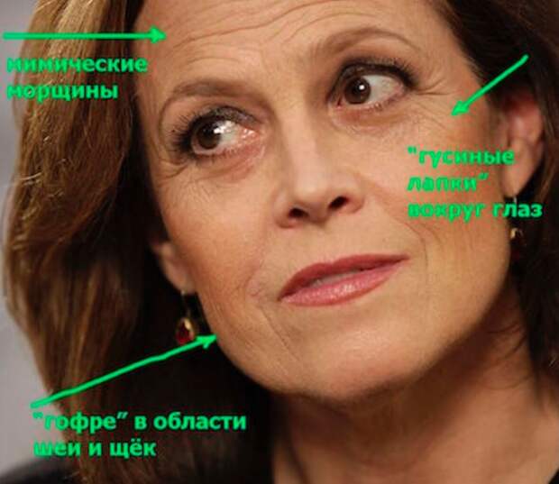 ТИПЫ СТАРЕНИЯ