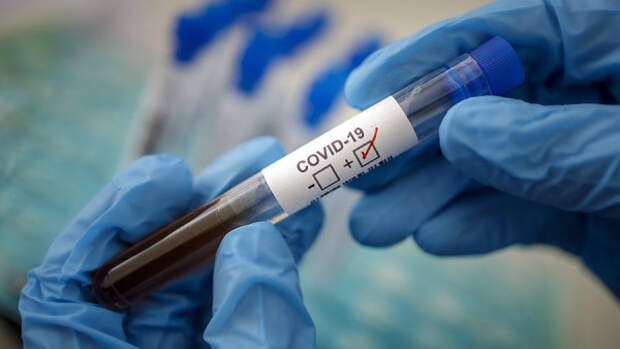 Частная лаборатория в Симферополе отложила проведение тестов на коронавирус 