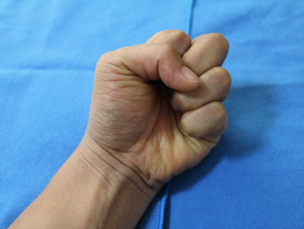 Председатель СКР затребовал доклад по делу об ампутации руки на производстве в Тольятти