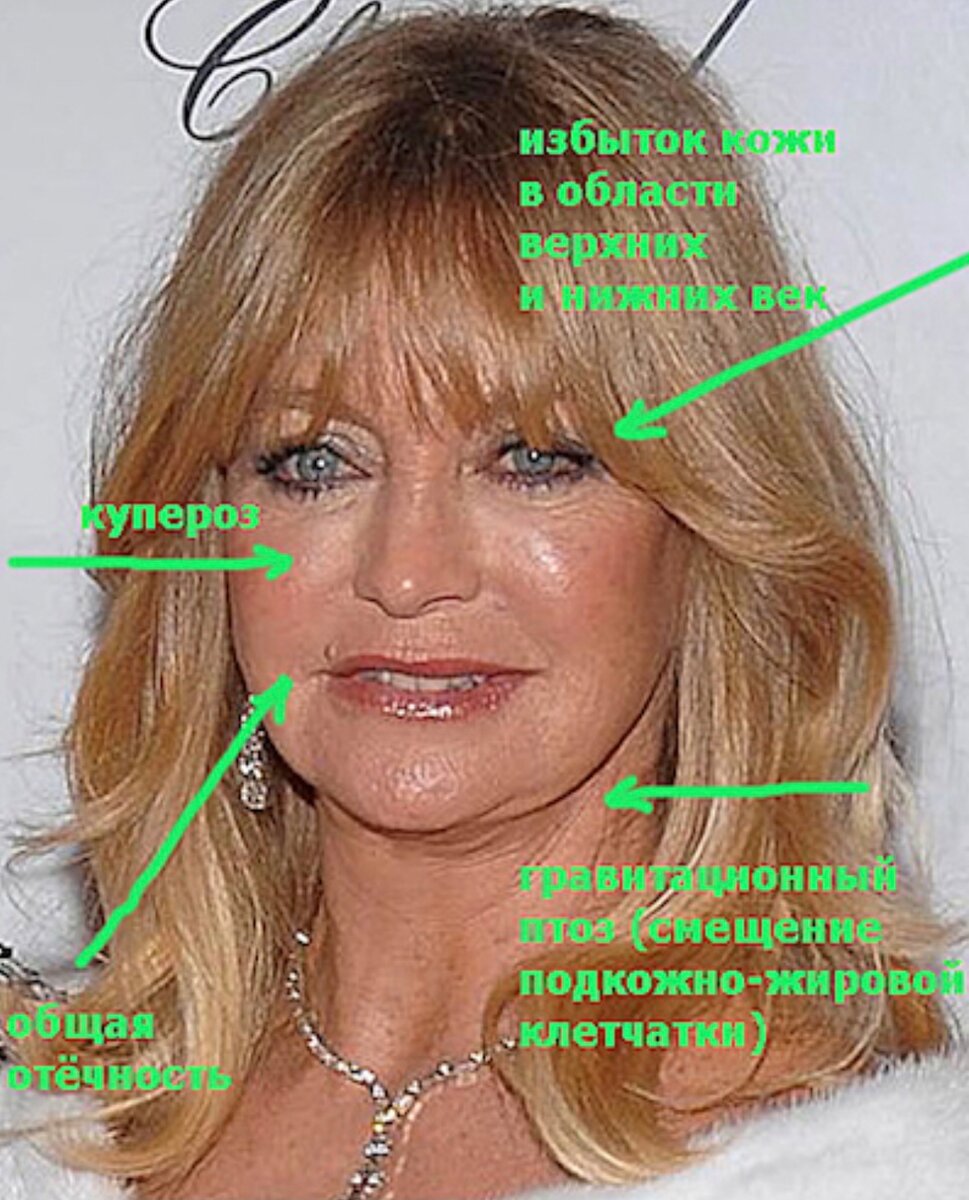 ТИПЫ СТАРЕНИЯ