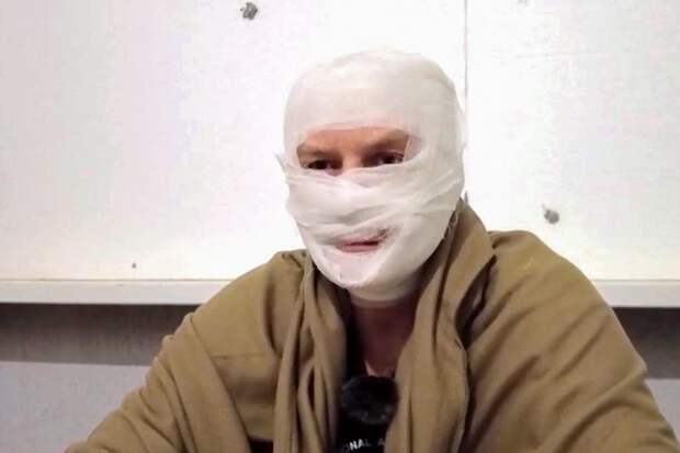 Треть солдат ВСУ выбывают из строя из-за обморожений