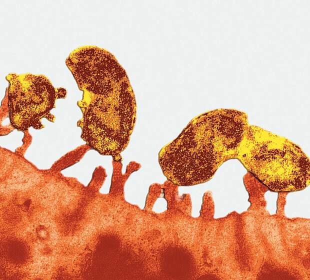 Это те самые бактерии Helicobacter Pylori, которые способствуют появлению язвы и гастрита. Впрочем, до сих пор некоторые ученые настаивают на том, что главная причина этих болезней — стресс и неправильное питание