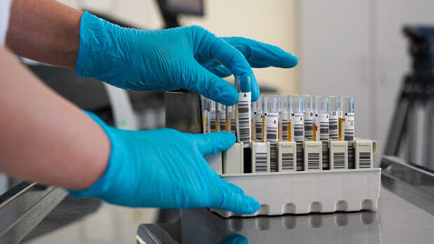 Анализ на ВПЧ стал доступен россиянкам по ОМС, его включили в диспансеризацию