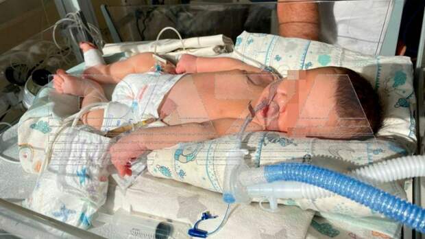 Новорожденный стал инвалидом / Фото: Baza