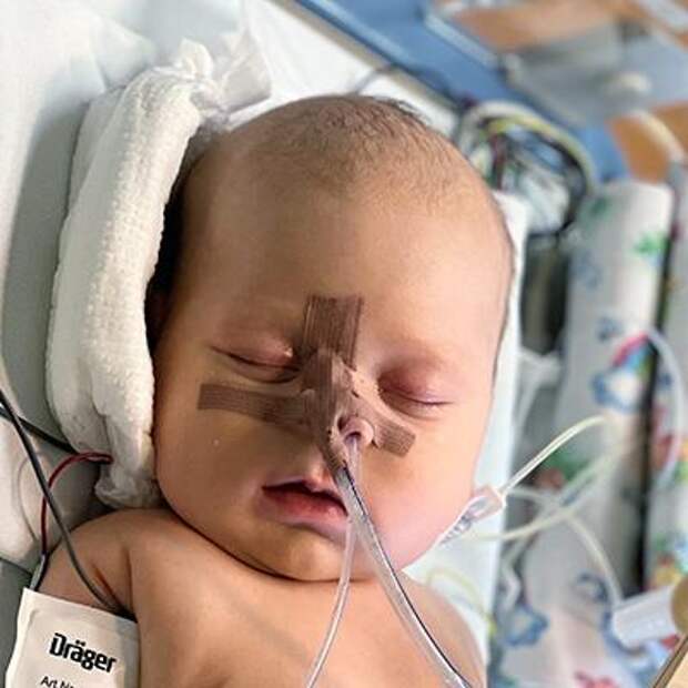 Гена Попов, 1 месяц, врожденный порок сердца, спасет операция, 594 825 ₽