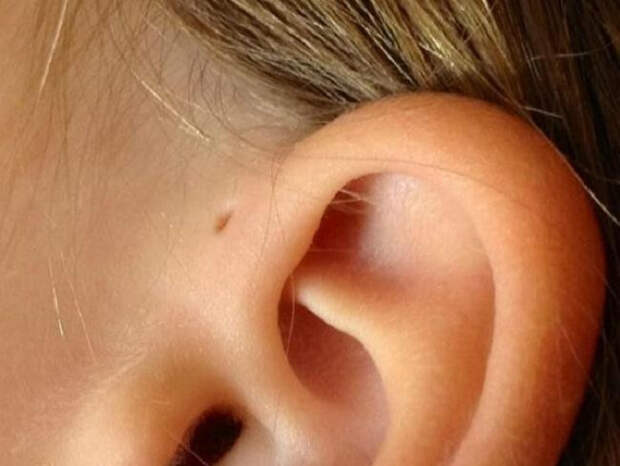 Небольшое отверстие рядом с ухом