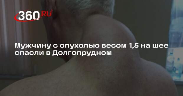 Мужчину с опухолью весом 1,5 кг на шее спасли в Долгопрудном