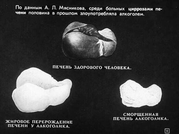 Алкоголизм и борьба с ним. Диафильм