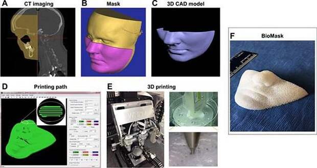 Инновационная маска улучшит заживление лицевых ранений (4 фото)