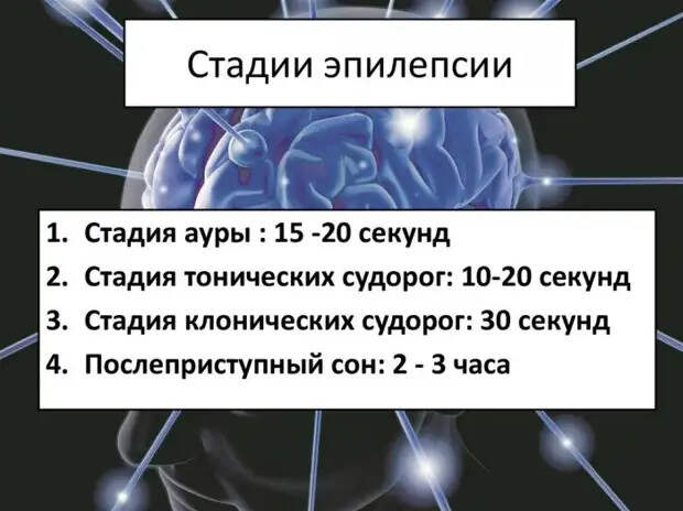 Что такое эпилепсия, и почему ее стоит бояться не только взрослым