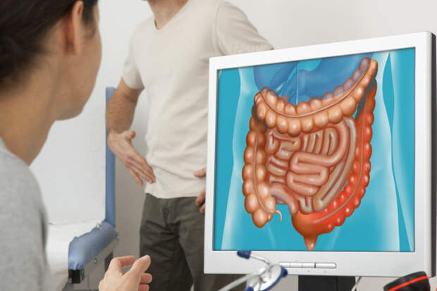 УЗИ кишечника или колоноскопия - какой вариант выбрать