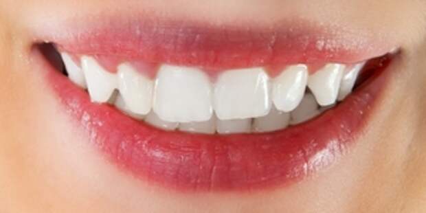 Народные средства для отбеливания зубов