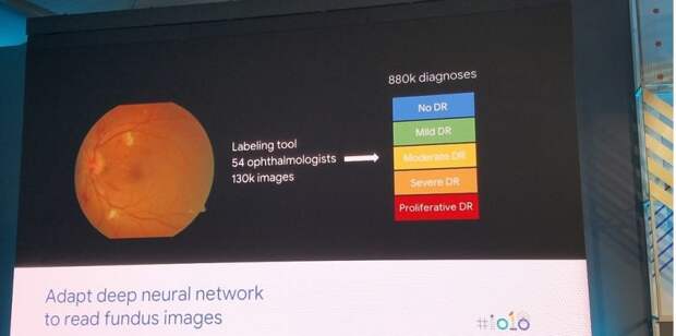 Seeing is believing: How AI could prevent blindness for 415 million people (right now)