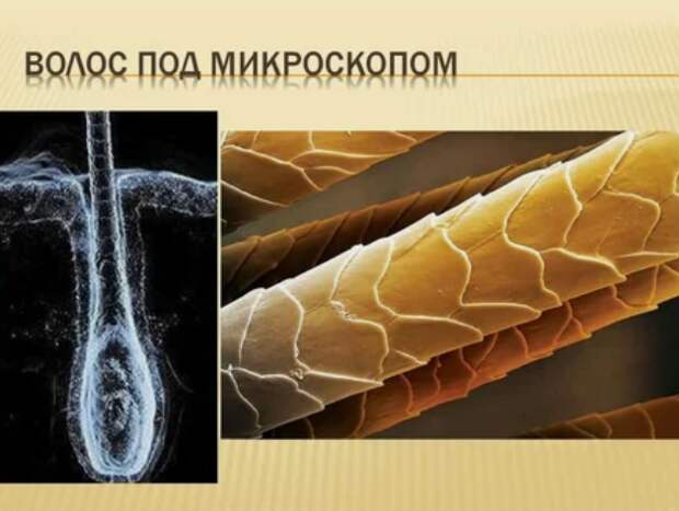 волос под микроскопом волос под микроскопом