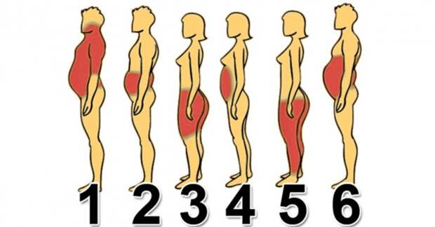 6 типов ожирения: Как справиться с каждым из них