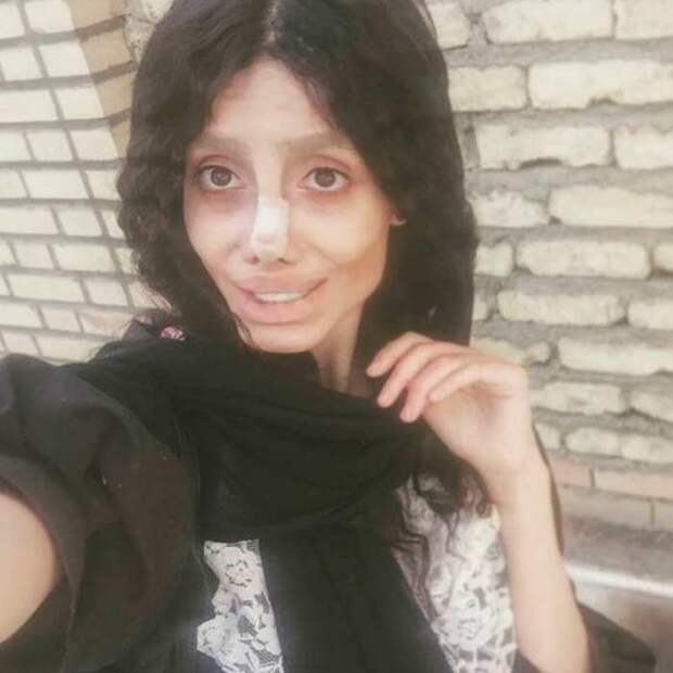 Сахар Табар сделала 50 пластических операций чтобы быть похожей на Анжелину Джоли