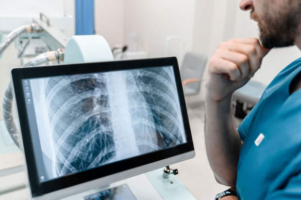 Ученый Кузьмин: в России самые устойчивые штаммы туберкулеза – МЛУ-ТБ и ШЛУ-ТБ