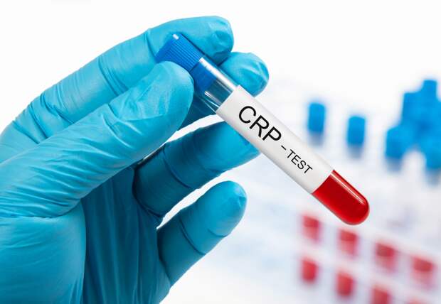 Холестерин уходит на второй план. Ученые назвали более точный индикатор угрозы для сердца