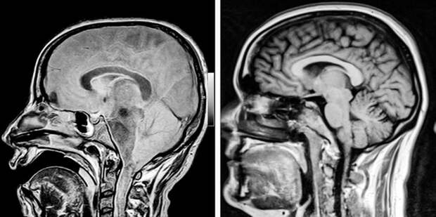 8 впечатляющих рентгеновских снимков, которые можно показывать на уроках анатомии вместо учебника